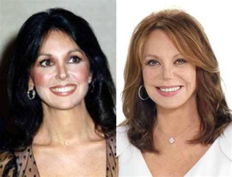 marlo thomas plastic surgery